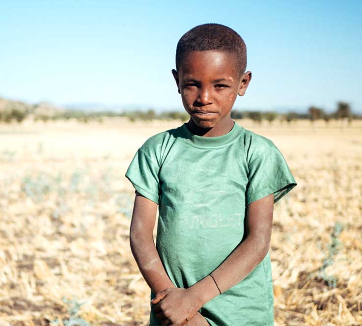 Enfant togolais démunie au soleil